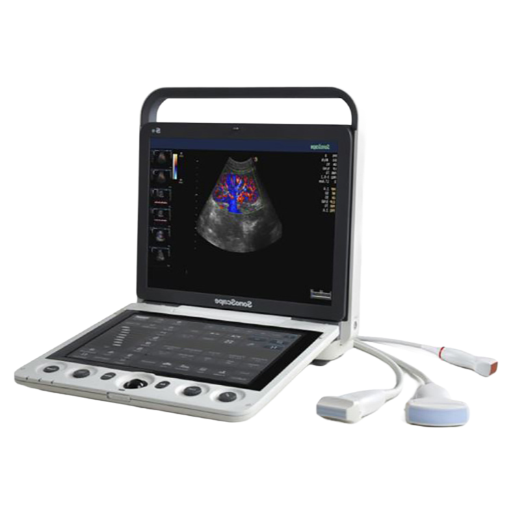 Wholesale OEM S9 Portable Ultrasound Scanner with High Density Probe & Spatial Imaging