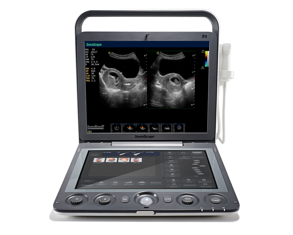 Wholesale OEM S9 Portable Ultrasound Scanner with High Density Probe & Spatial Imaging