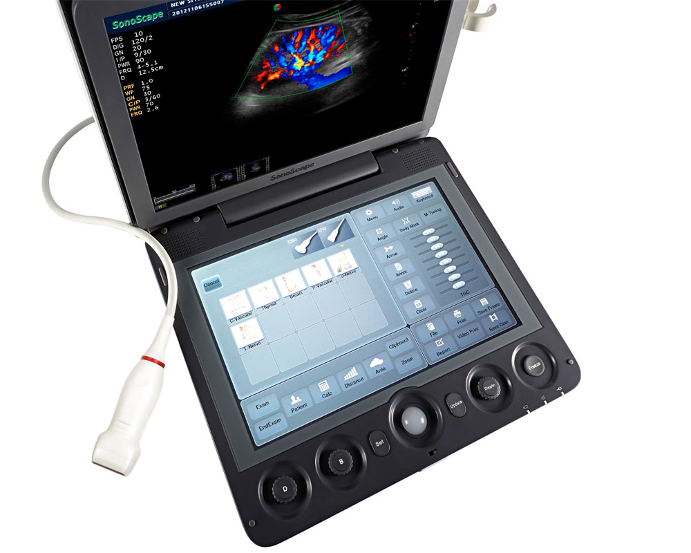 Wholesale OEM S9 Portable Ultrasound Scanner with High Density Probe & Spatial Imaging