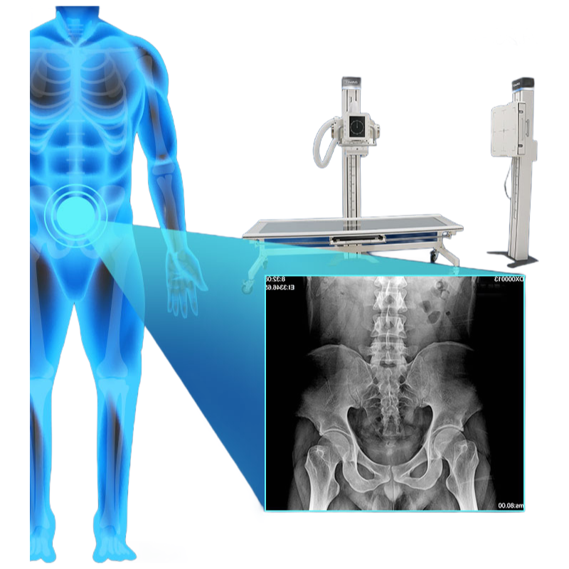 Customizable DR850X Digital Radiography System with DICOM 3.0 Networking Interface