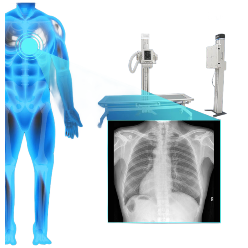 Customizable DR850X Digital Radiography System with DICOM 3.0 Networking Interface