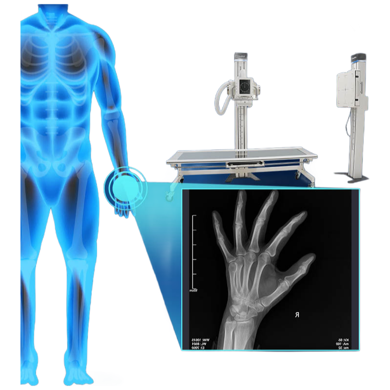 Customizable DR850X Digital Radiography System with DICOM 3.0 Networking Interface