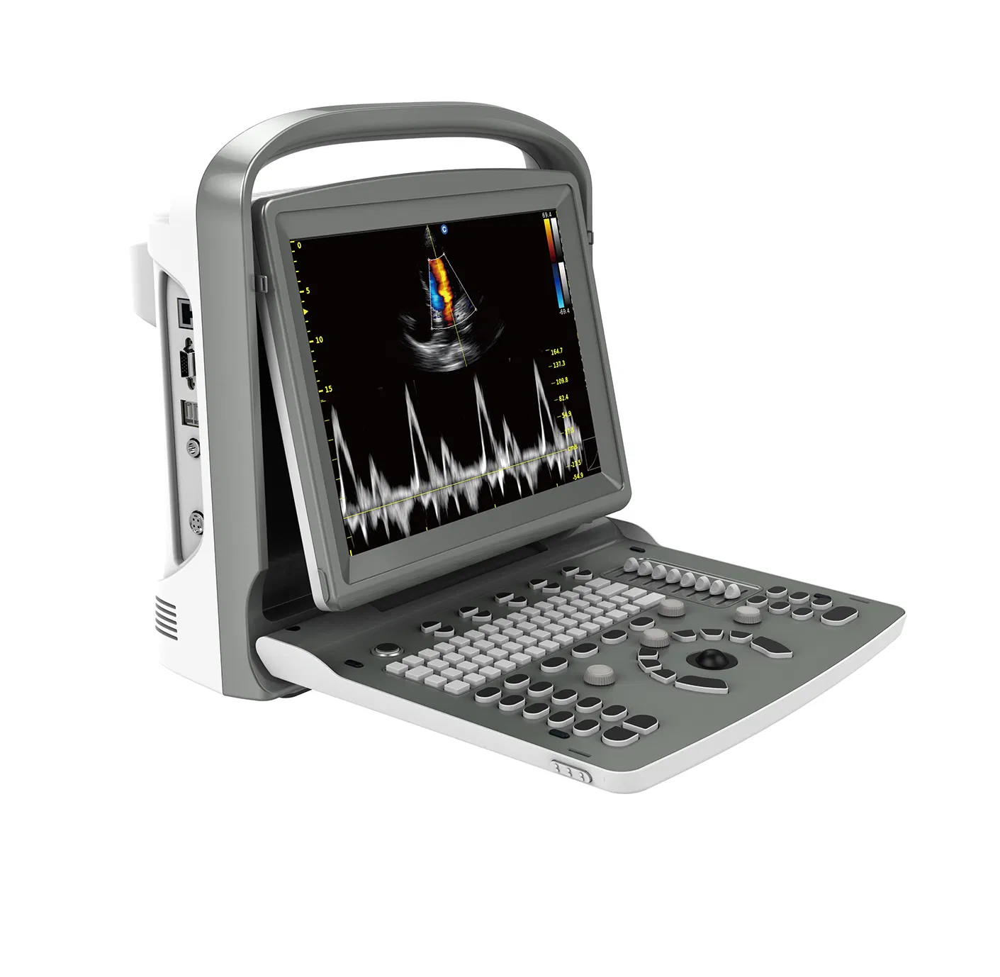 Factory Supply Chison ECO6 Portable Ultrasound Machine with Vascular Application