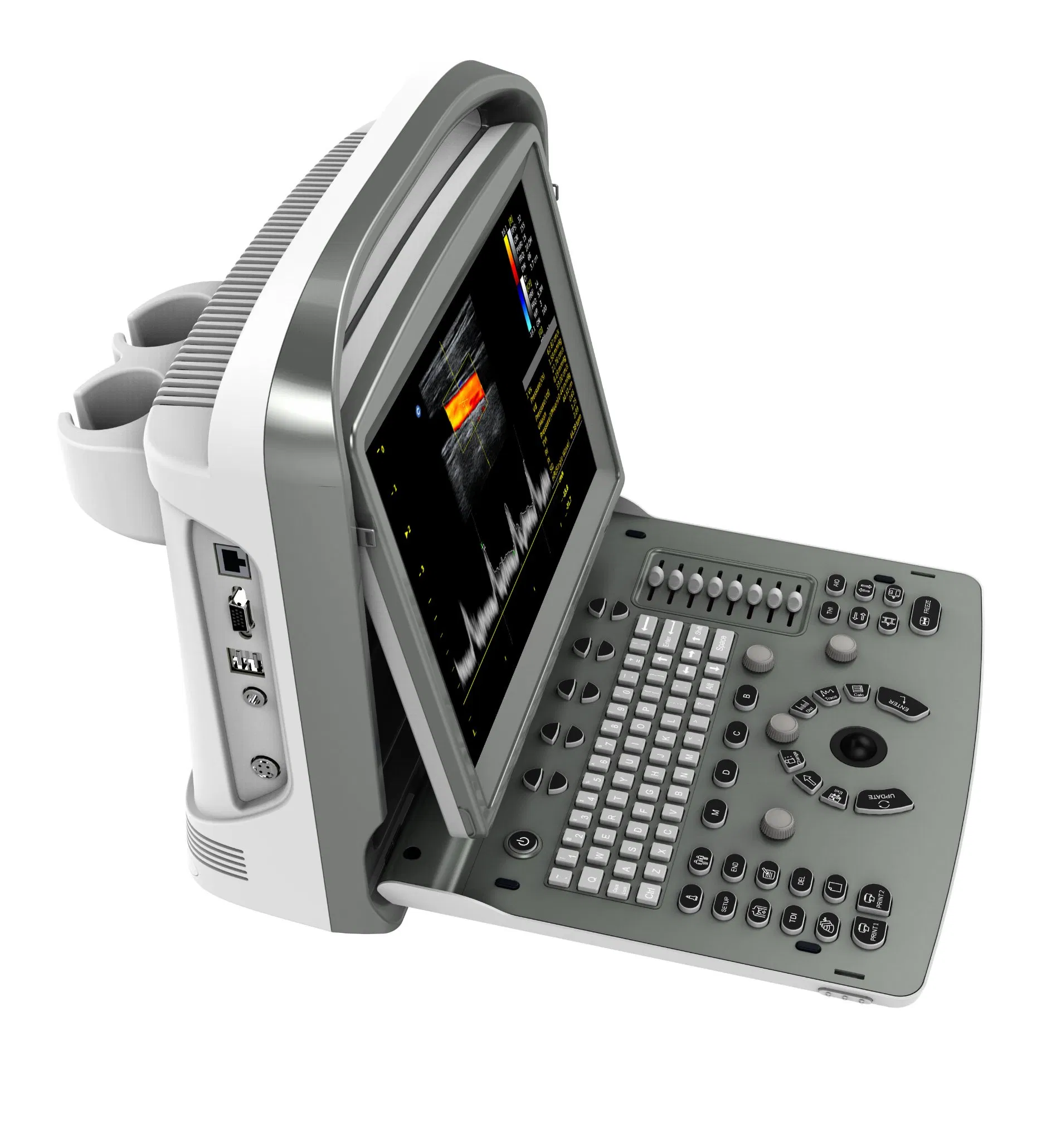 Factory Supply Chison ECO6 Portable Ultrasound Machine with Vascular Application