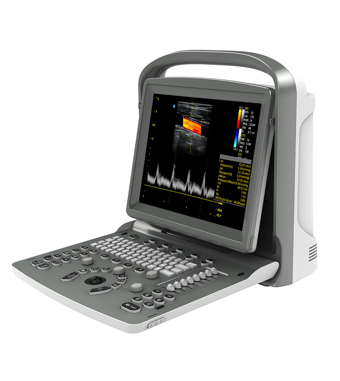 Factory Supply Chison ECO6 Portable Ultrasound Machine with Vascular Application