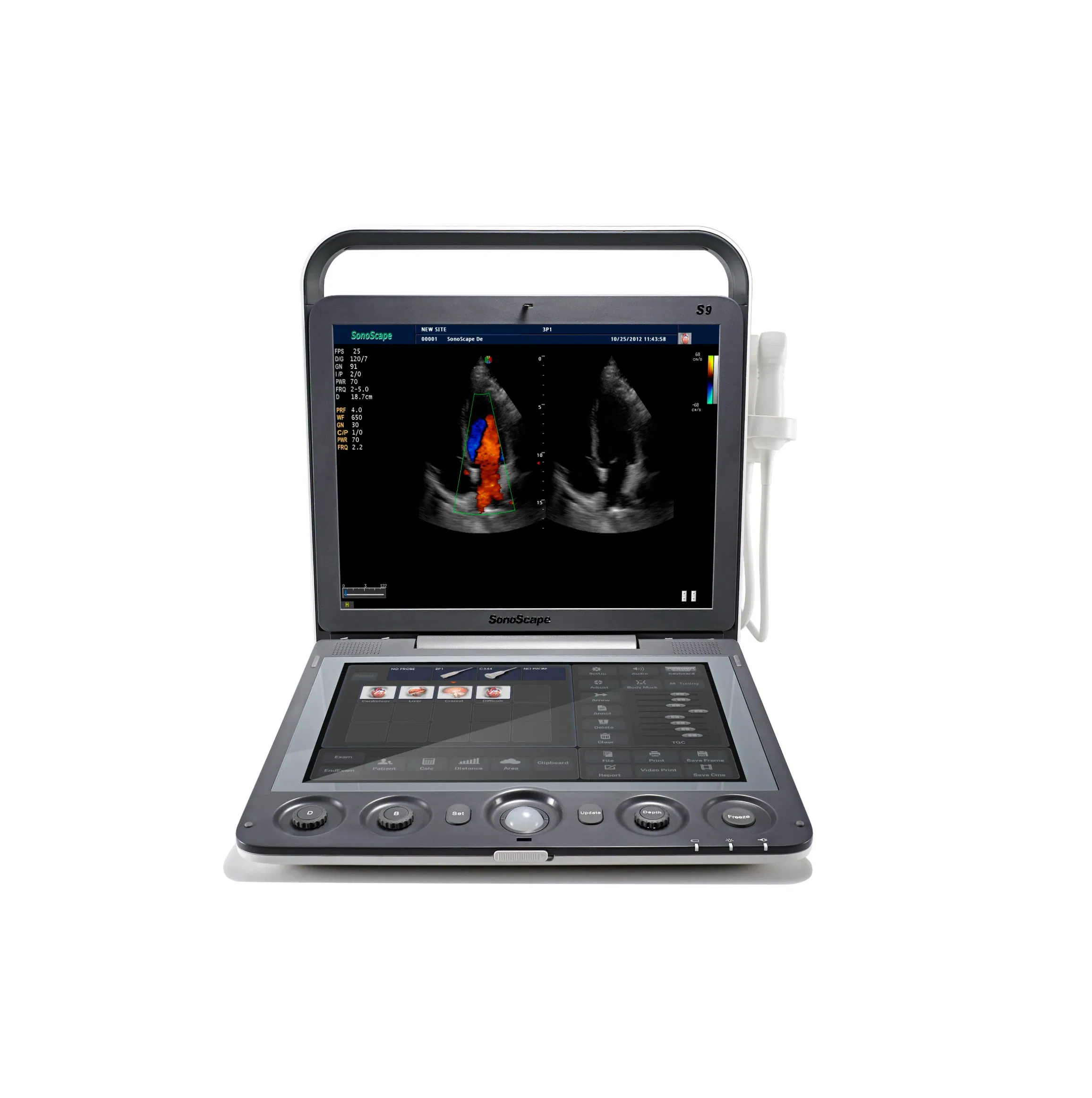 High Performance S9 Series Color Doppler Ultrasound Machine with Multi-beam Technology
