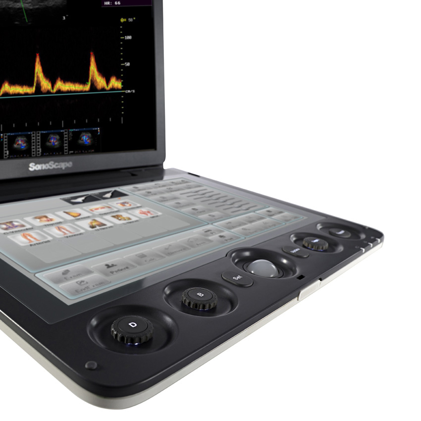 High Performance S9 Series Color Doppler Ultrasound Machine with Multi-beam Technology