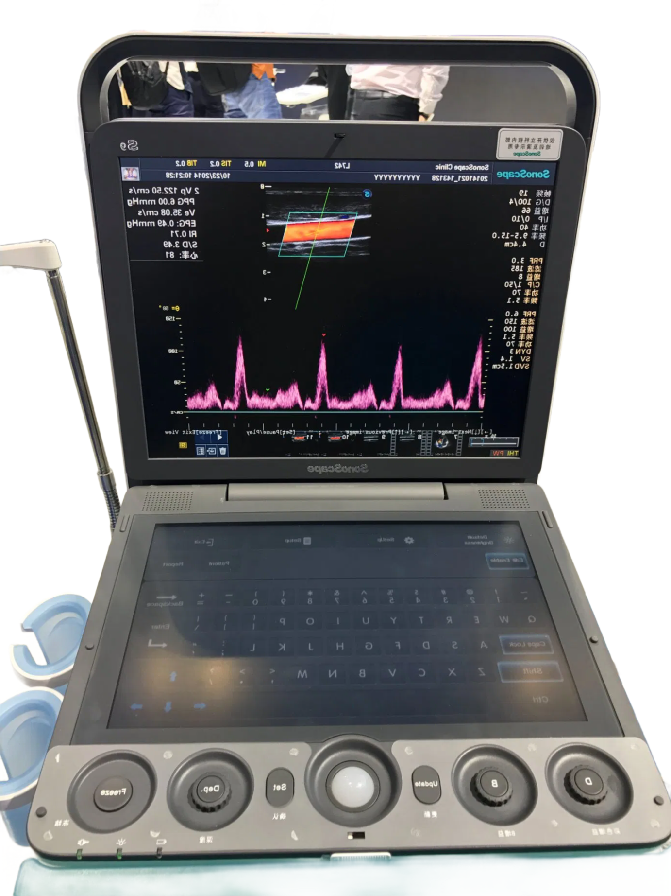 High Performance S9 Series Color Doppler Ultrasound Machine with Multi-beam Technology