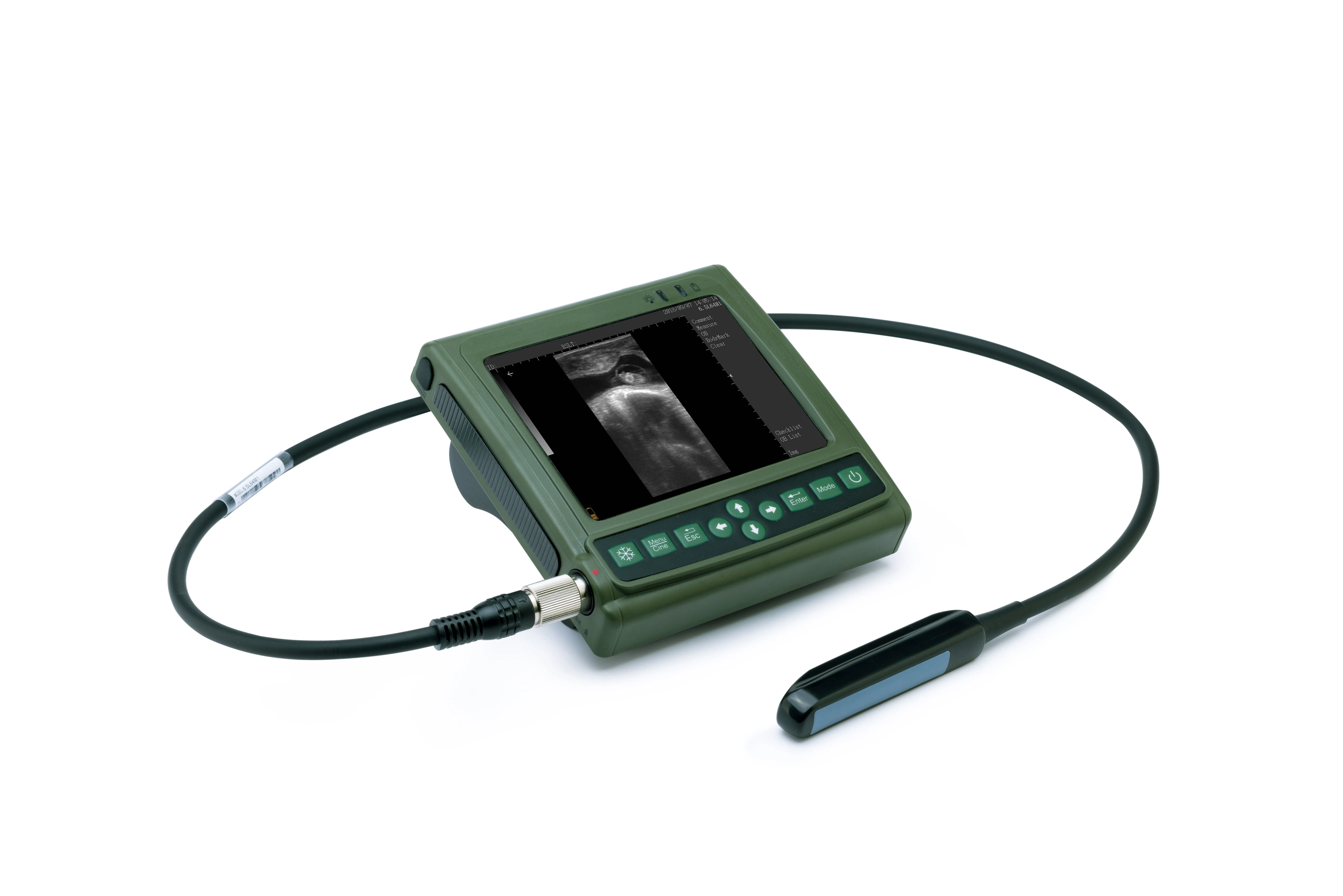 Smart Lightweight Veterinary Ultrasound Scanner with OB Record and Diagnosis List Function