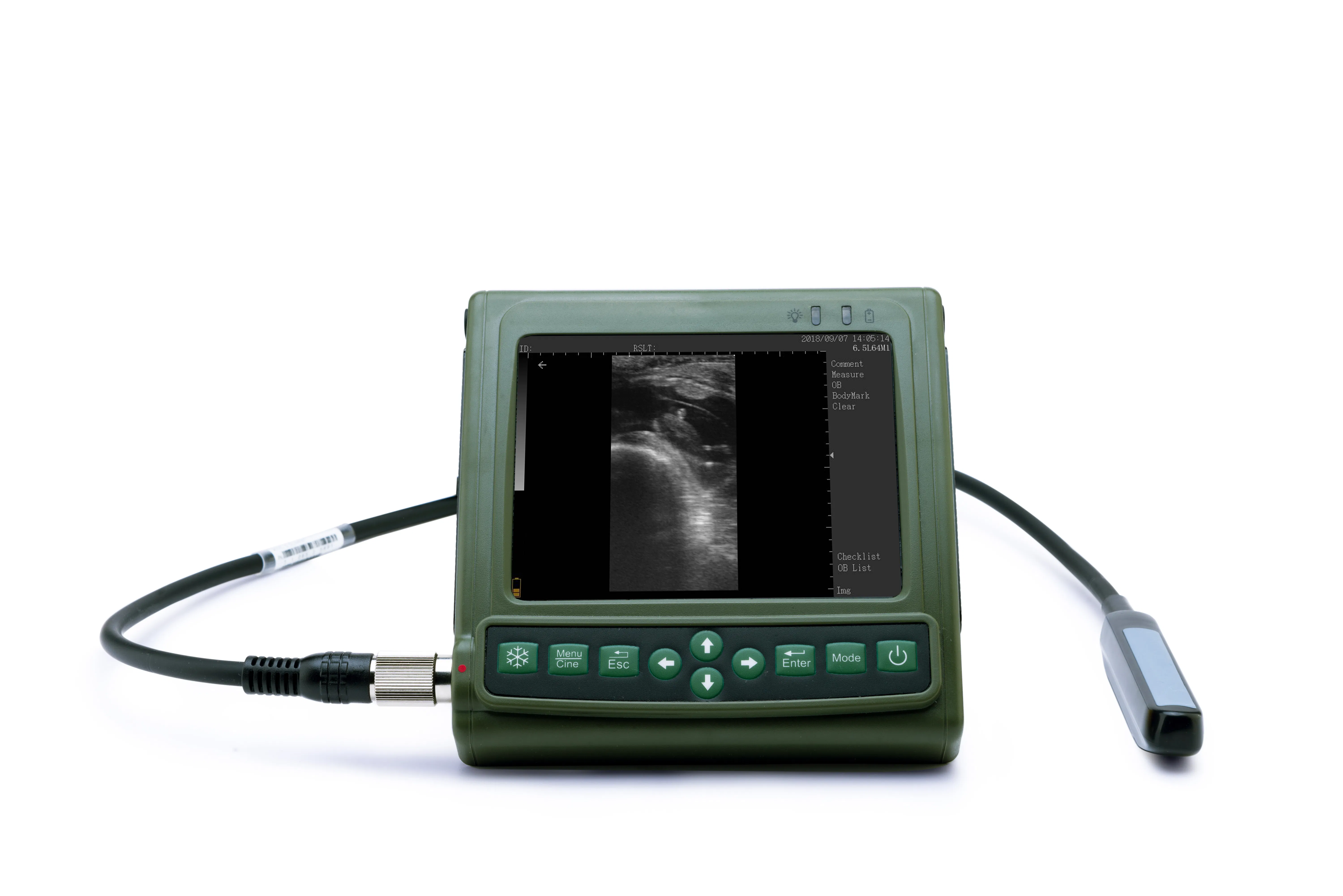 Smart Lightweight Veterinary Ultrasound Scanner with OB Record and Diagnosis List Function