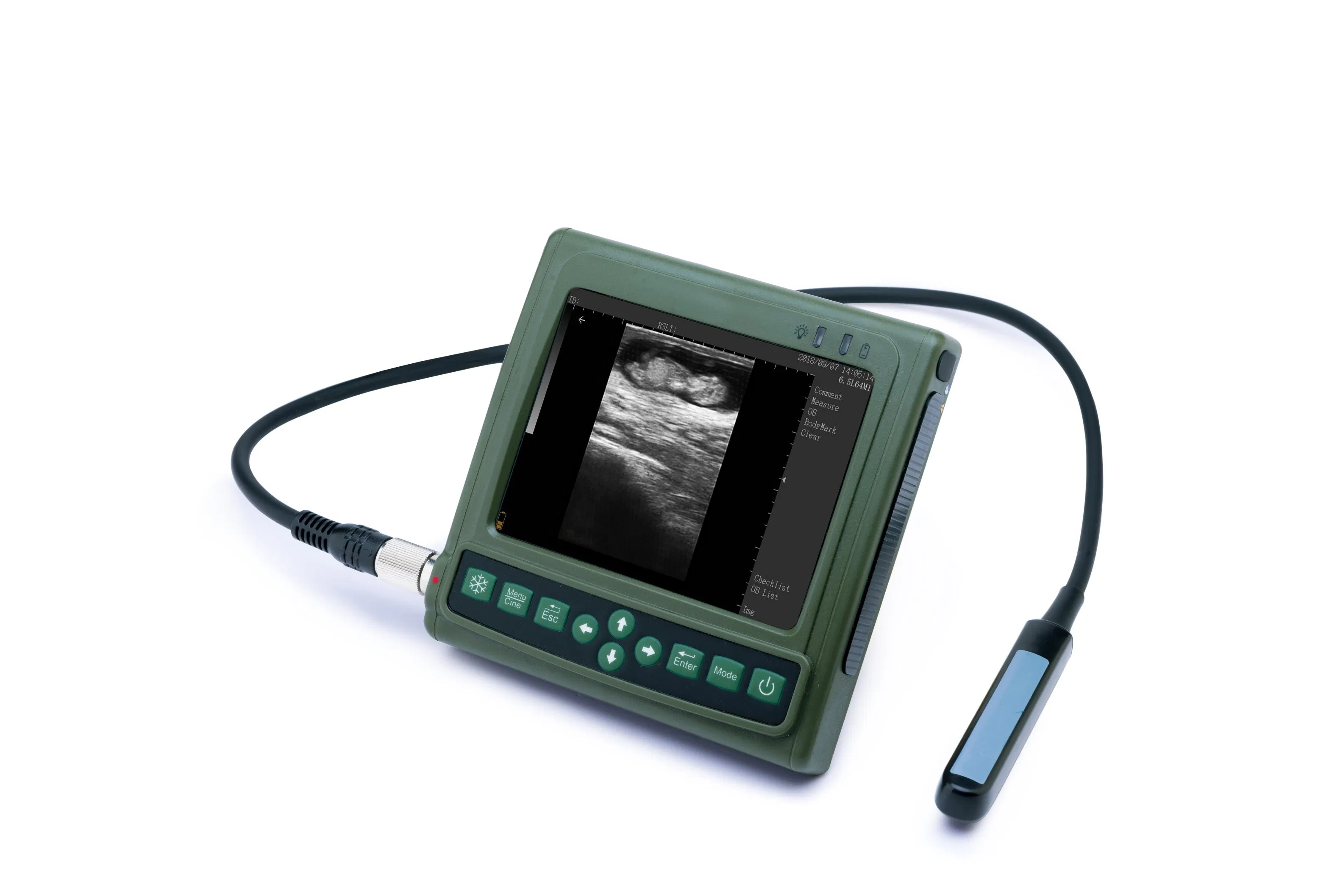 Smart Lightweight Veterinary Ultrasound Scanner with OB Record and Diagnosis List Function