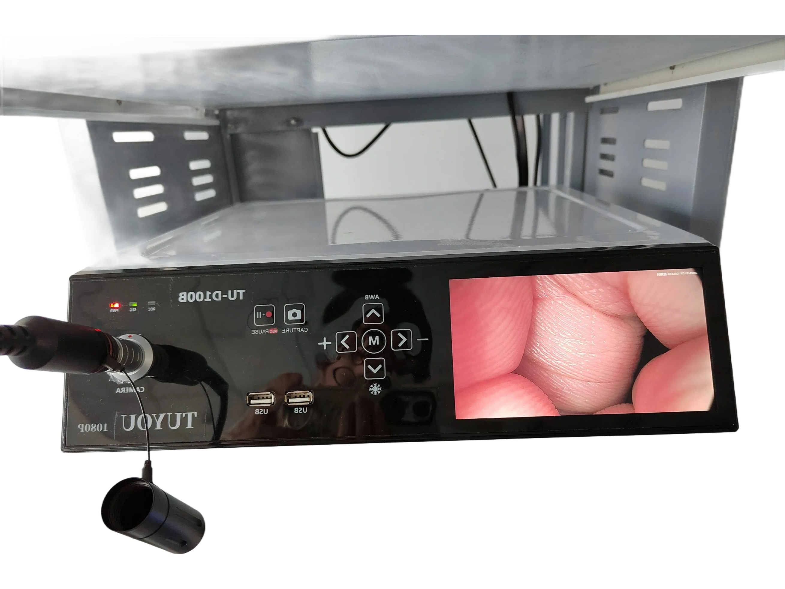 Medical Grade Endoscopic Imaging System with 1/2