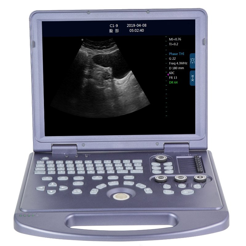 Professional DW-360 Medical Ultrasound Equipment with Multi-Display Modes and DICOM Interface