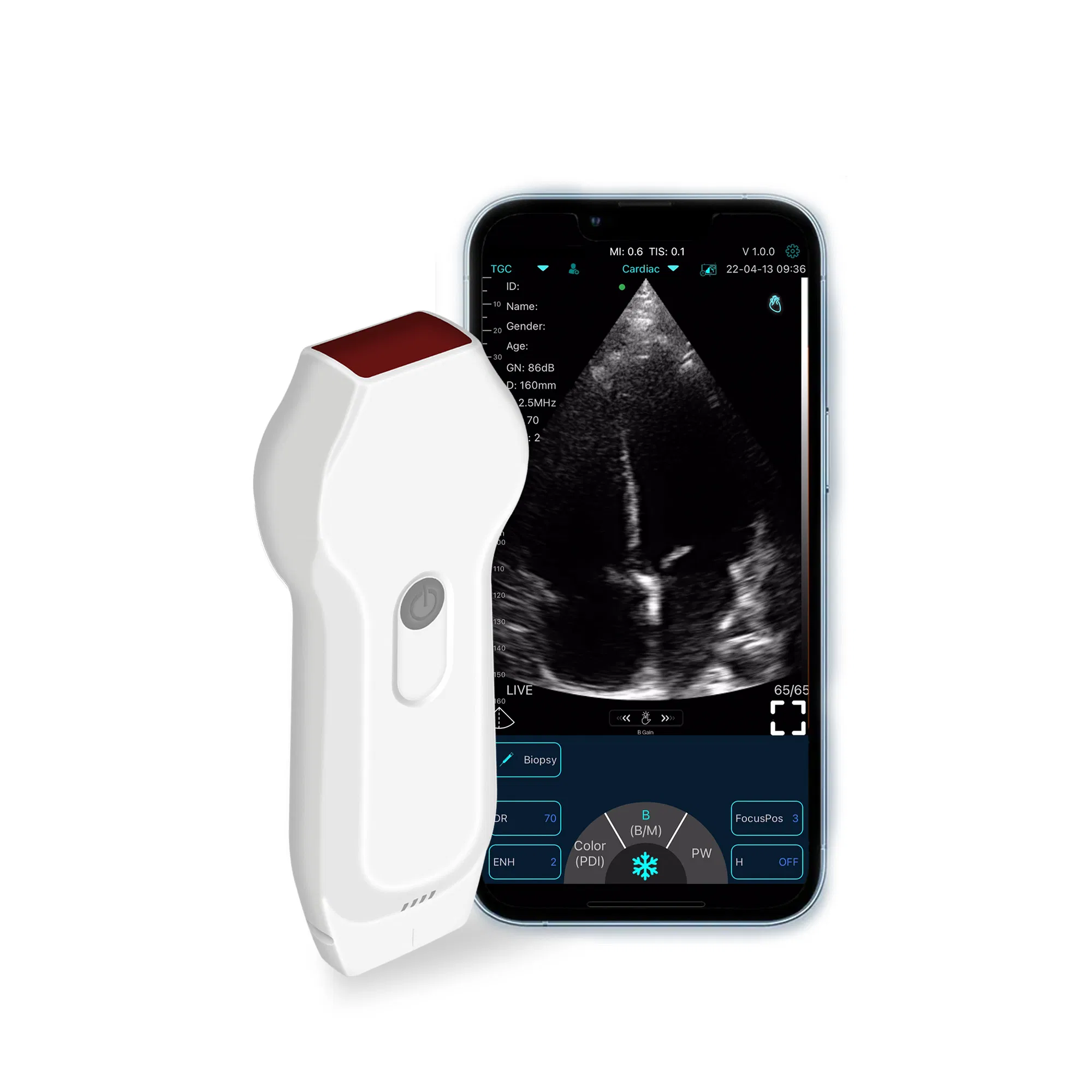 Professional Grade Dual-Probe Ultrasound System C10XL with Dicom Image Storage Capability