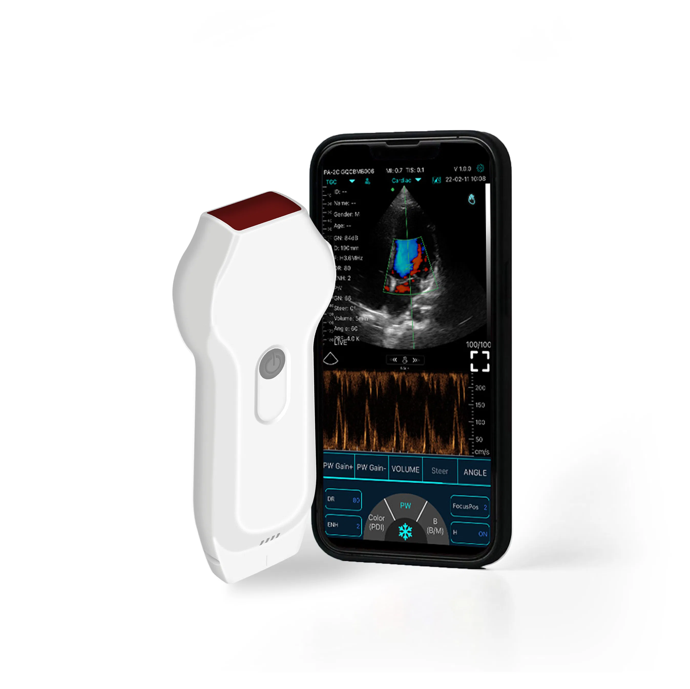 Professional Grade Dual-Probe Ultrasound System C10XL with Dicom Image Storage Capability