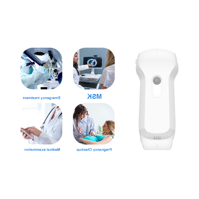Konted C10RL Dual-Probe Wireless Ultrasound Scanner with Convex Linear Cardiac Probes for Medical Imaging