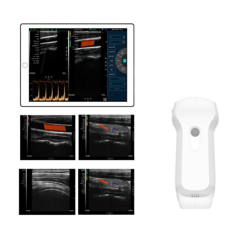 Konted C10RL Dual-Probe Wireless Ultrasound Scanner with Convex Linear Cardiac Probes for Medical Imaging