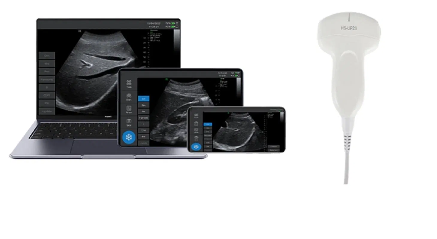 Medical Grade Handheld Ultrasound Device with 256 Grayscale Display