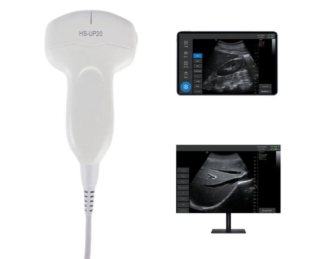 Medical Grade Handheld Ultrasound Device with 256 Grayscale Display