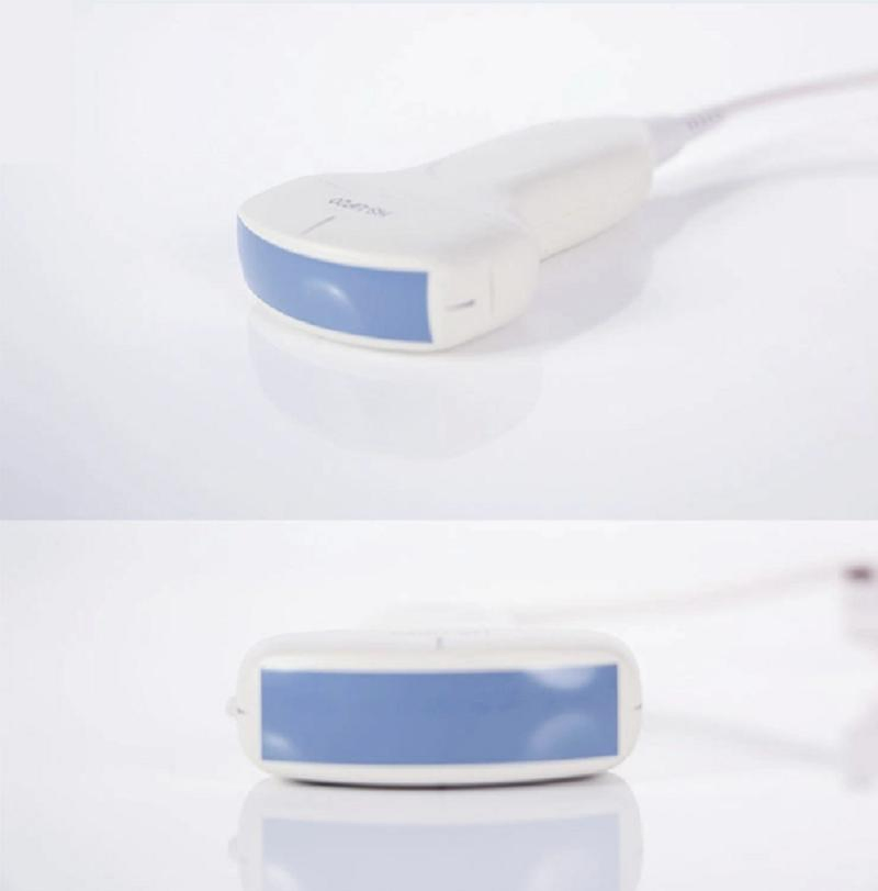 Medical Grade Handheld Ultrasound Device with 256 Grayscale Display