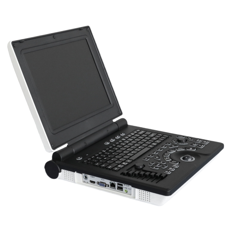 Portable Notebook Color Doppler Ultrasound Scanner E20 - High Resolution Medical Diagnostic Imaging Device