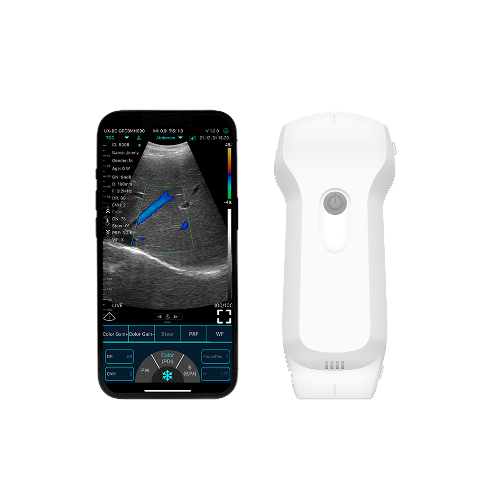 Konted C10RL Dual-Probe Portable Ultrasound Scanner - 3-in-1 Convex Linear Cardiac Probe for Medical Diagnostics