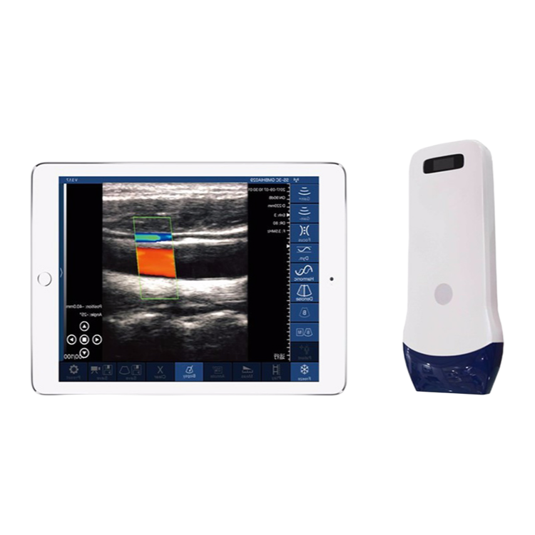Customizable WiFi Ultrasound Transducer Machine for Hospitals with CE FDA EEC ISO13485 Certification