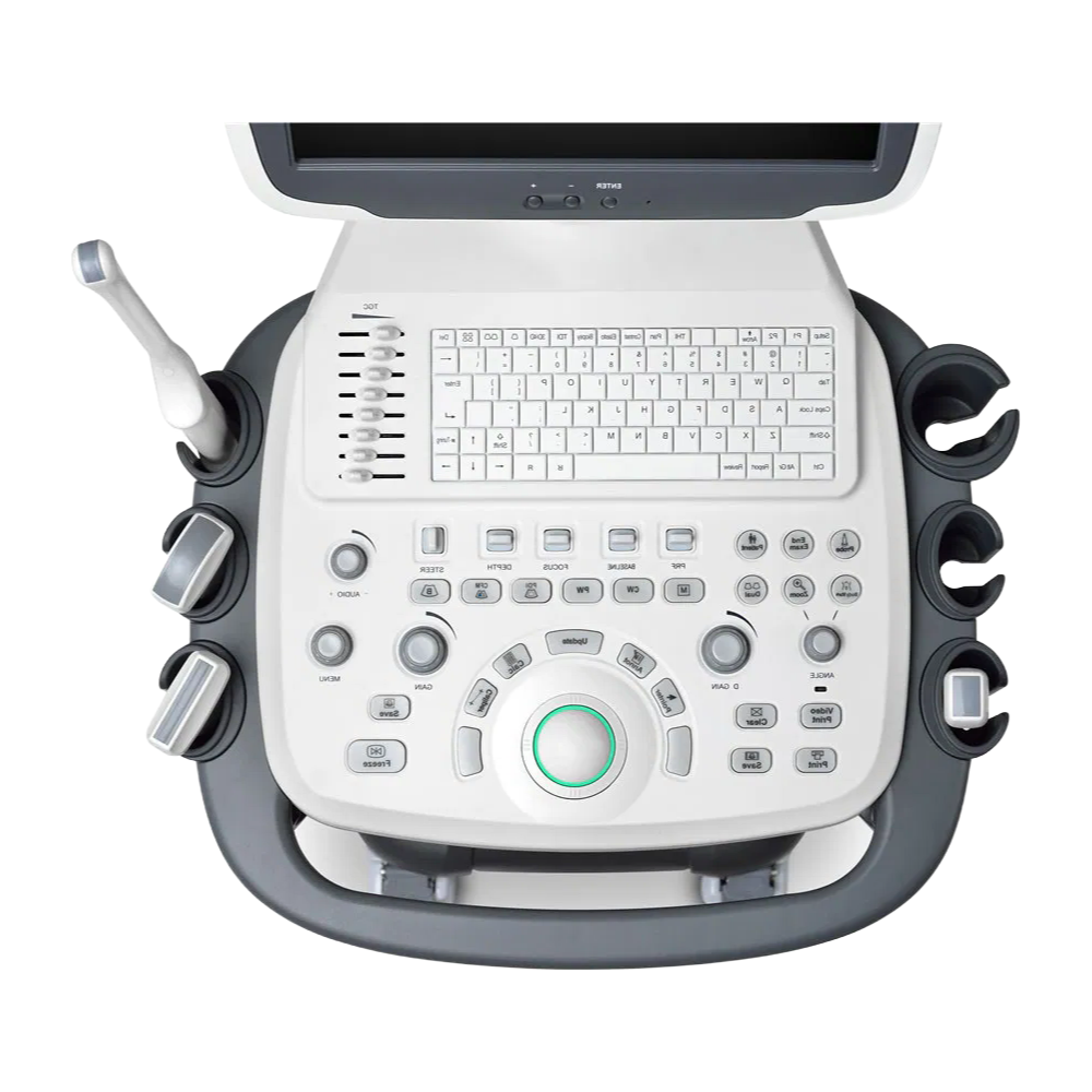 S12 Compact Ultrasound Scanner for Obstetric and Gynecologic Applications with Real-Time Imaging