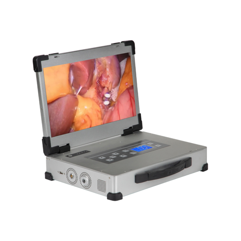 Customizable HD Endoscope Camera System with 17.3