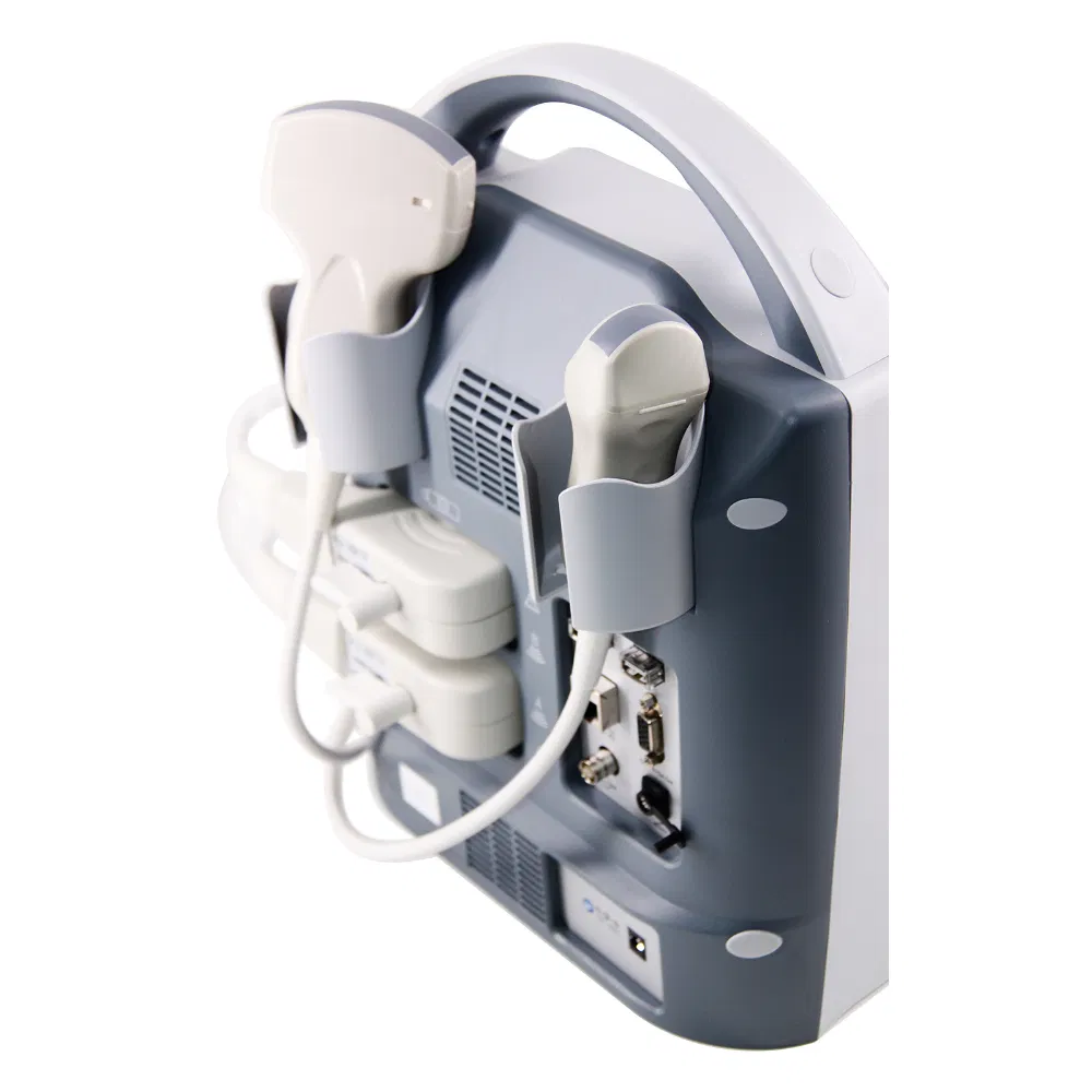 UM-5600 Color Ultrasound Machine with 256-Color Imaging for Medical Diagnostics - CE Certified