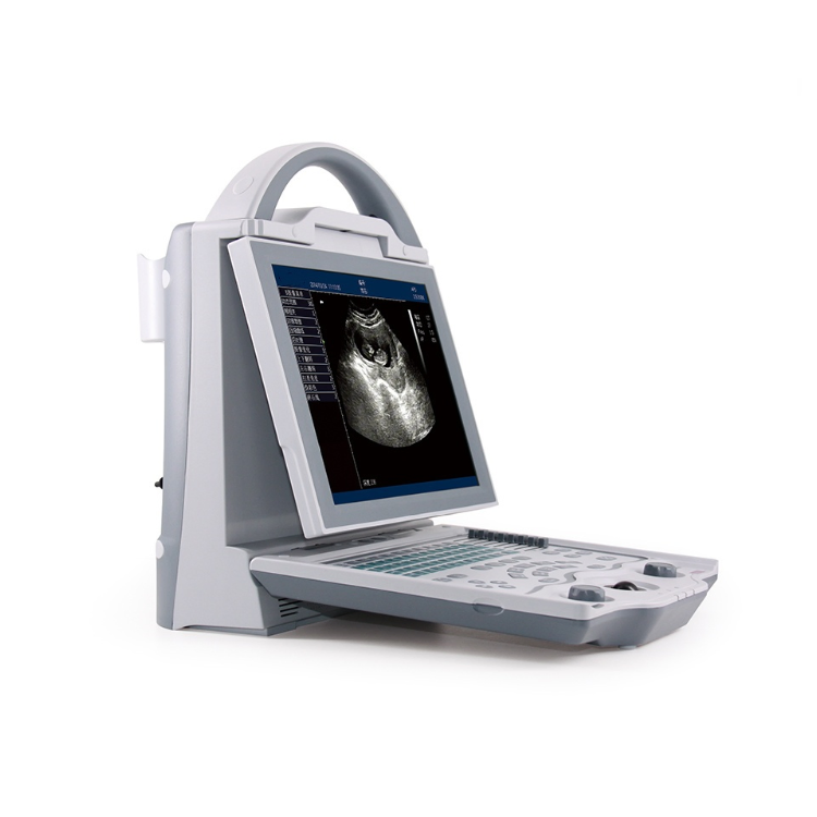 UM-5600 Color Ultrasound Machine with 256-Color Imaging for Medical Diagnostics - CE Certified