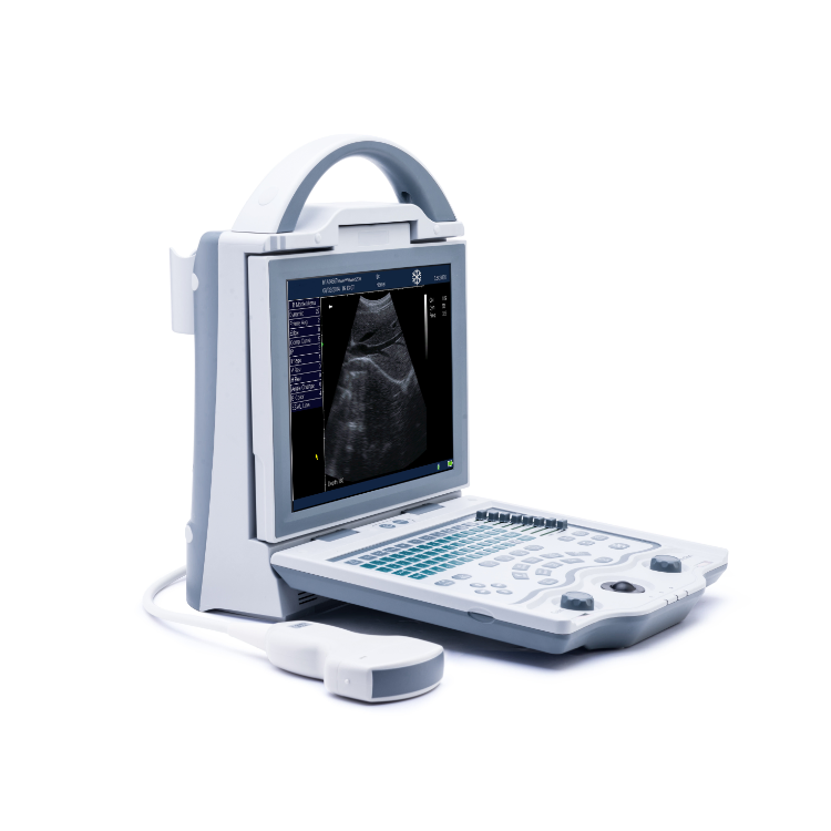 UM-5600 Color Ultrasound Machine with 256-Color Imaging for Medical Diagnostics - CE Certified