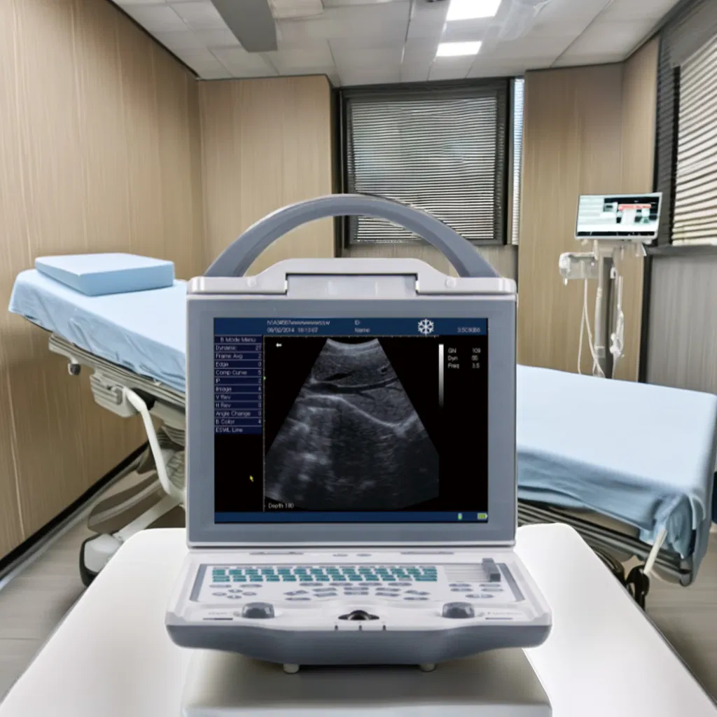 UM-5600 Color Ultrasound Machine with 256-Color Imaging for Medical Diagnostics - CE Certified