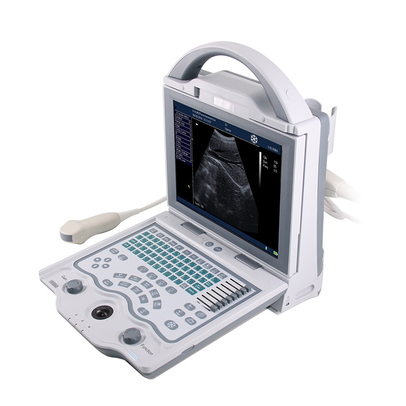 UM-5600 Color Ultrasound Machine with 256-Color Imaging for Medical Diagnostics - CE Certified