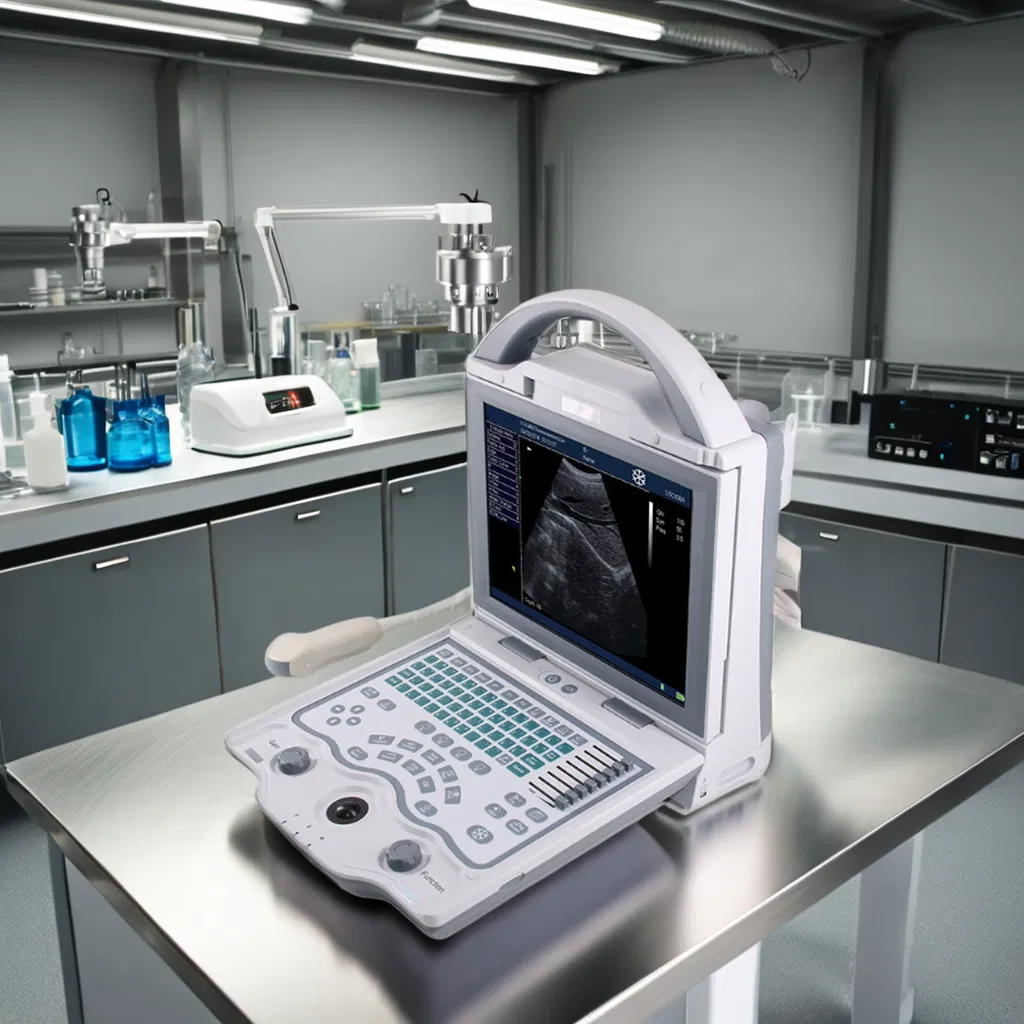 UM-5600 Color Ultrasound Machine with 256-Color Imaging for Medical Diagnostics - CE Certified