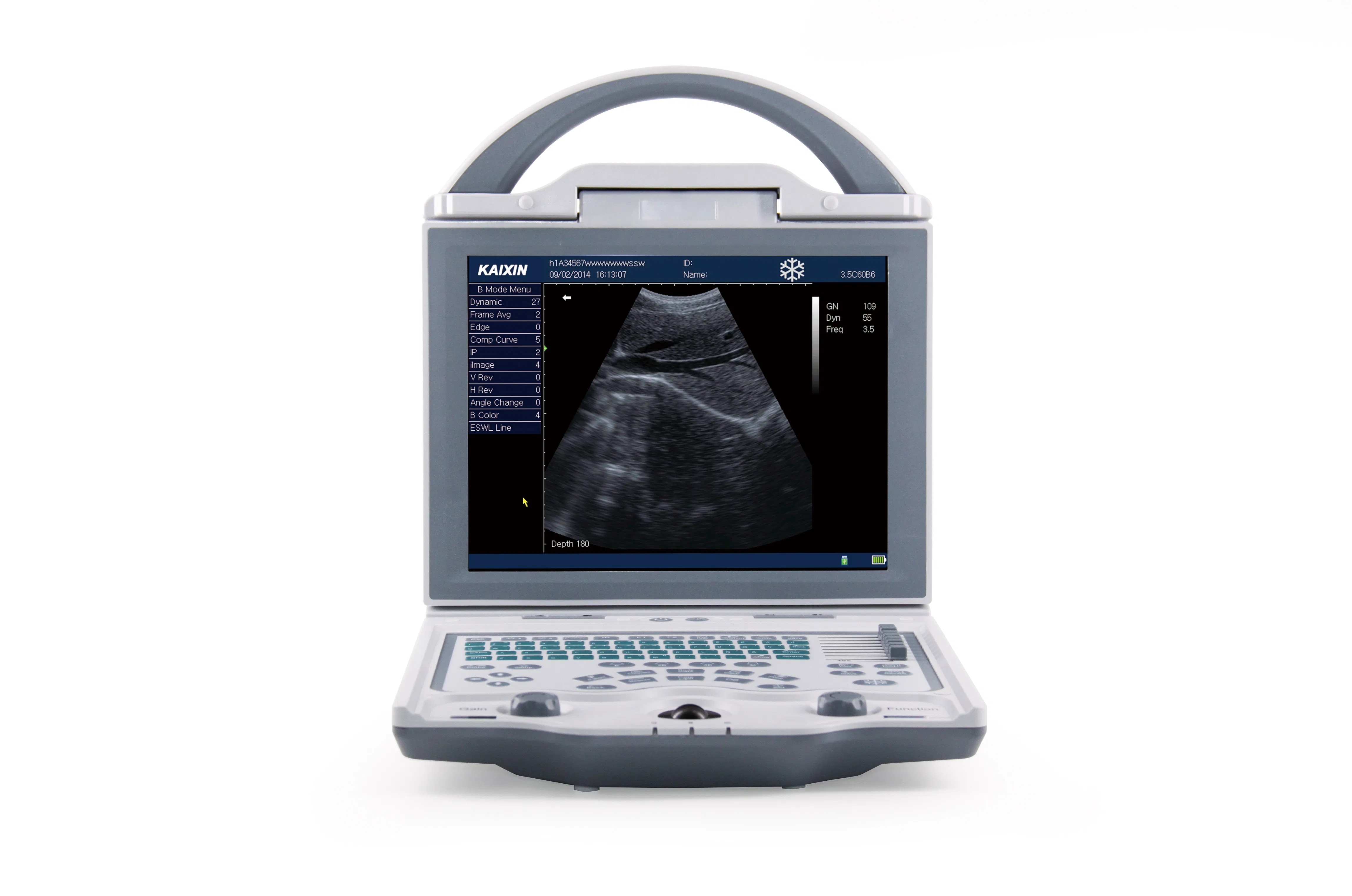 Factory Supply KX5600 Medical Ultrasound Scanner for Abdomen Gyn Ob Urology Applications