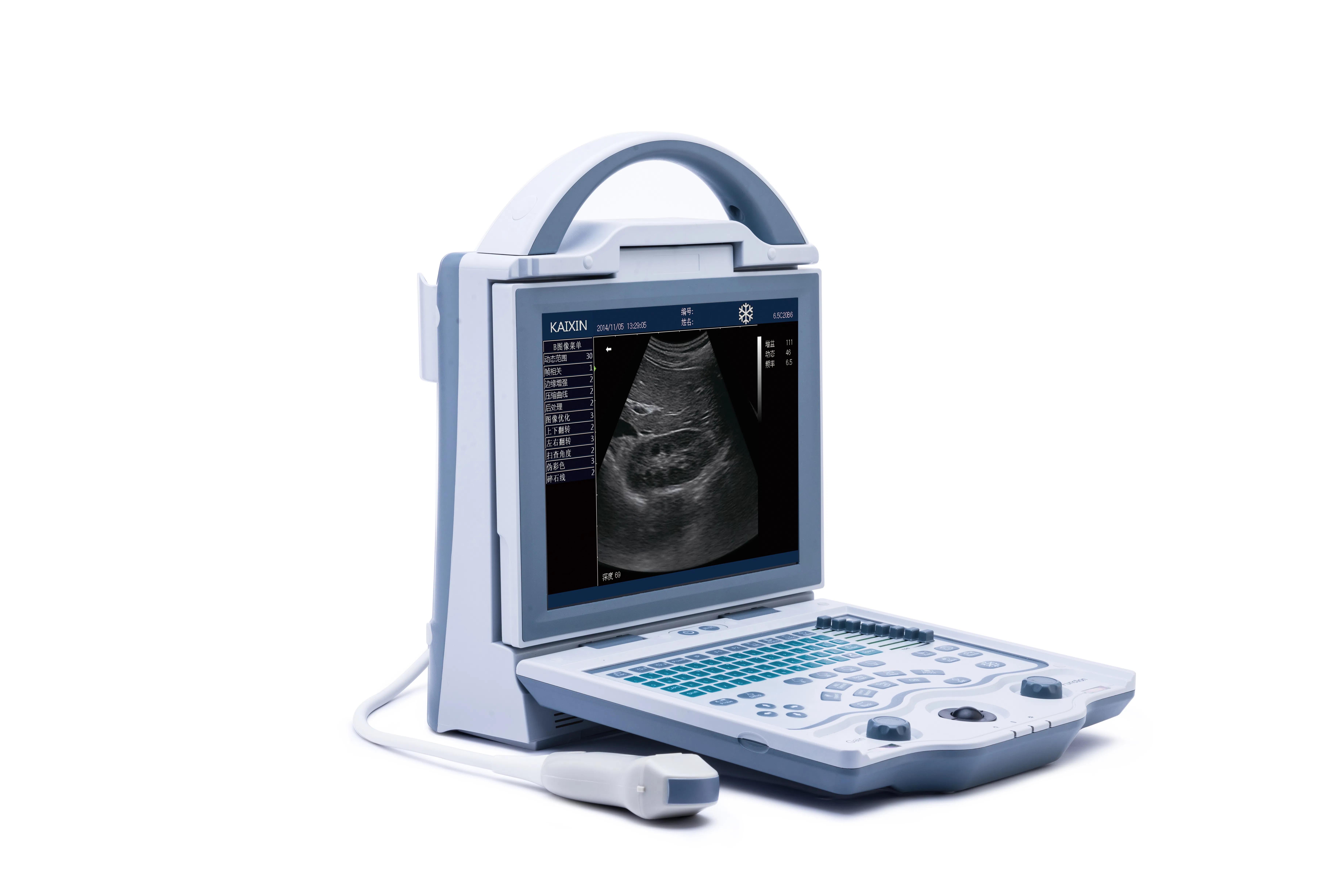 Factory Supply KX5600 Medical Ultrasound Scanner for Abdomen Gyn Ob Urology Applications