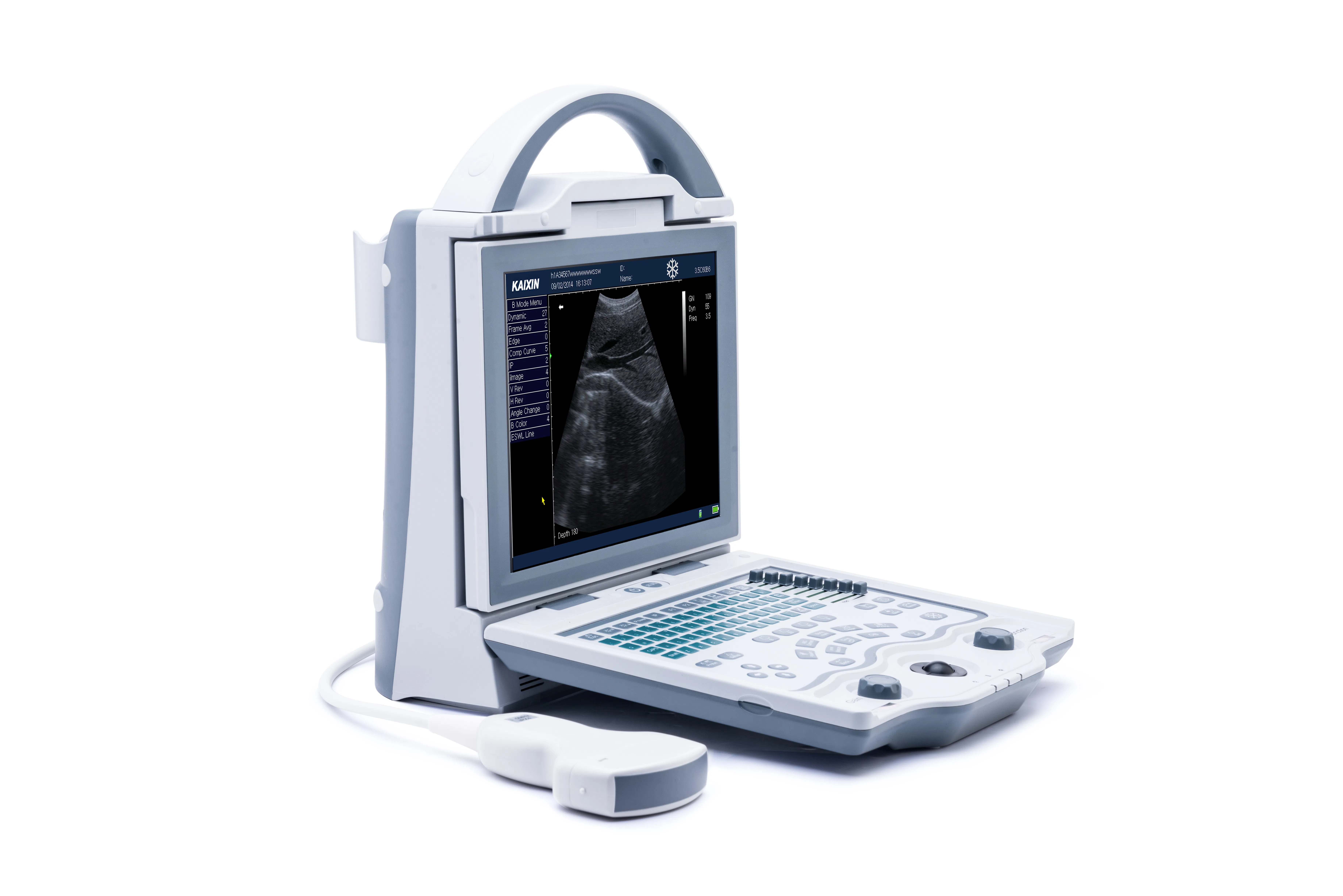 Factory Supply KX5600 Medical Ultrasound Scanner for Abdomen Gyn Ob Urology Applications