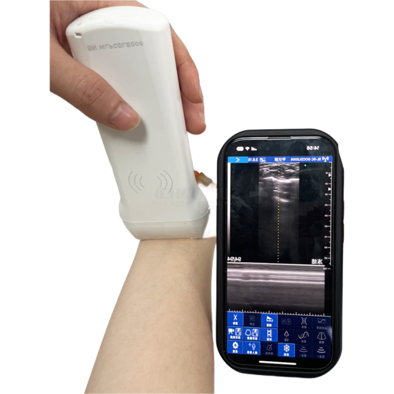 Compact Waterproof Ultrasonic Probe with 3-5 Hours Battery Life for Remote Diagnosis