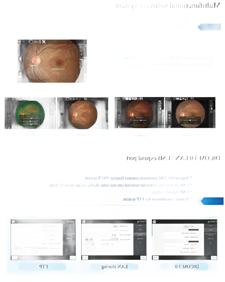 MY-V036D Non-Mydriatic Retinal Fundus Camera for Ophthalmology Diagnosis and Eye Examination