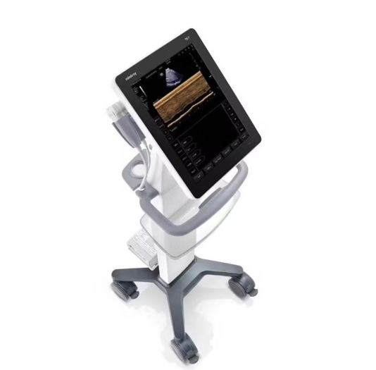 High-Quality TE7S Diagnostic Ultrasound Machine with 17/19
