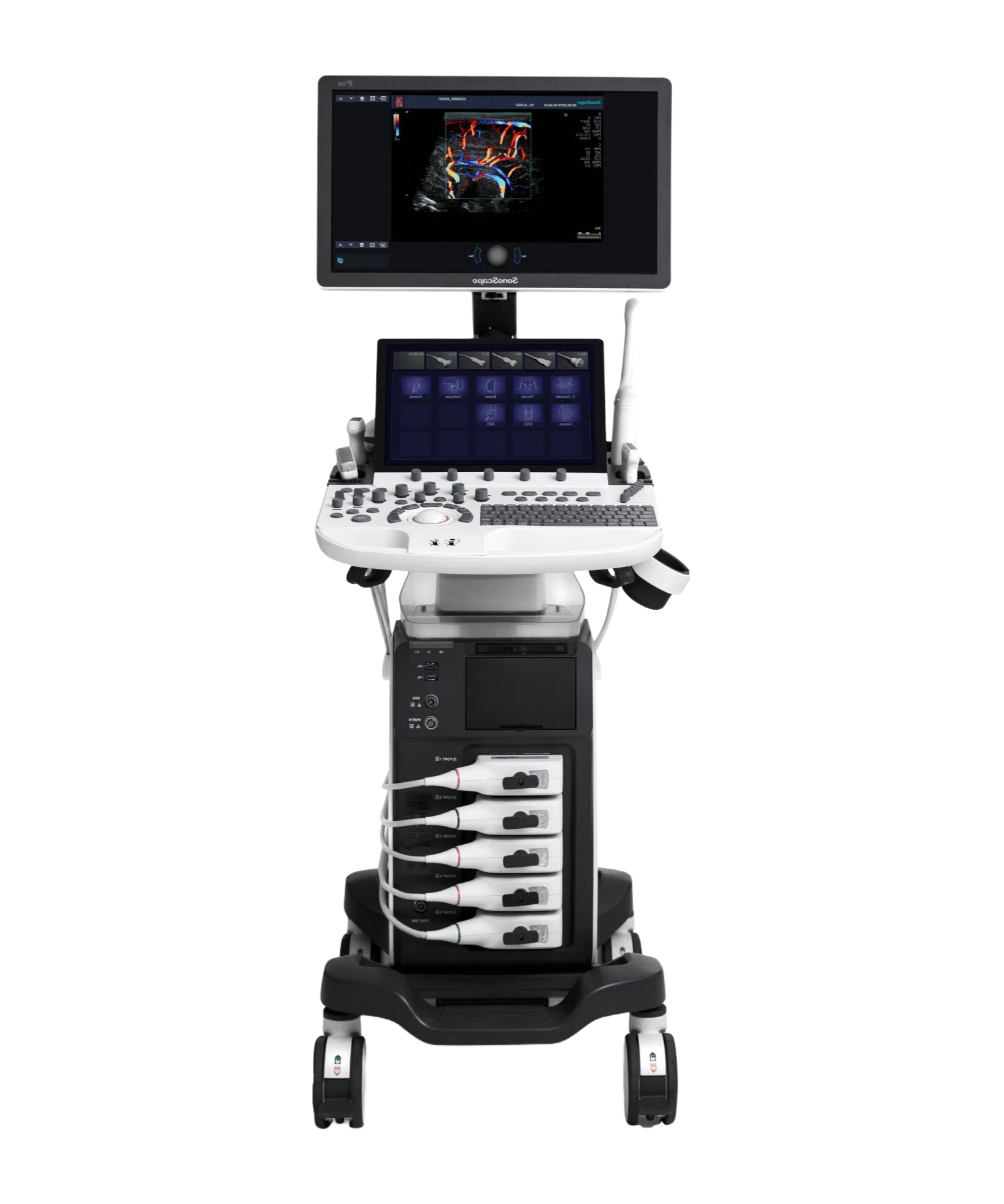 Compact SonoScape P50 5D Ultrasound System for Clinical Examinations and Fetal Abnormalities