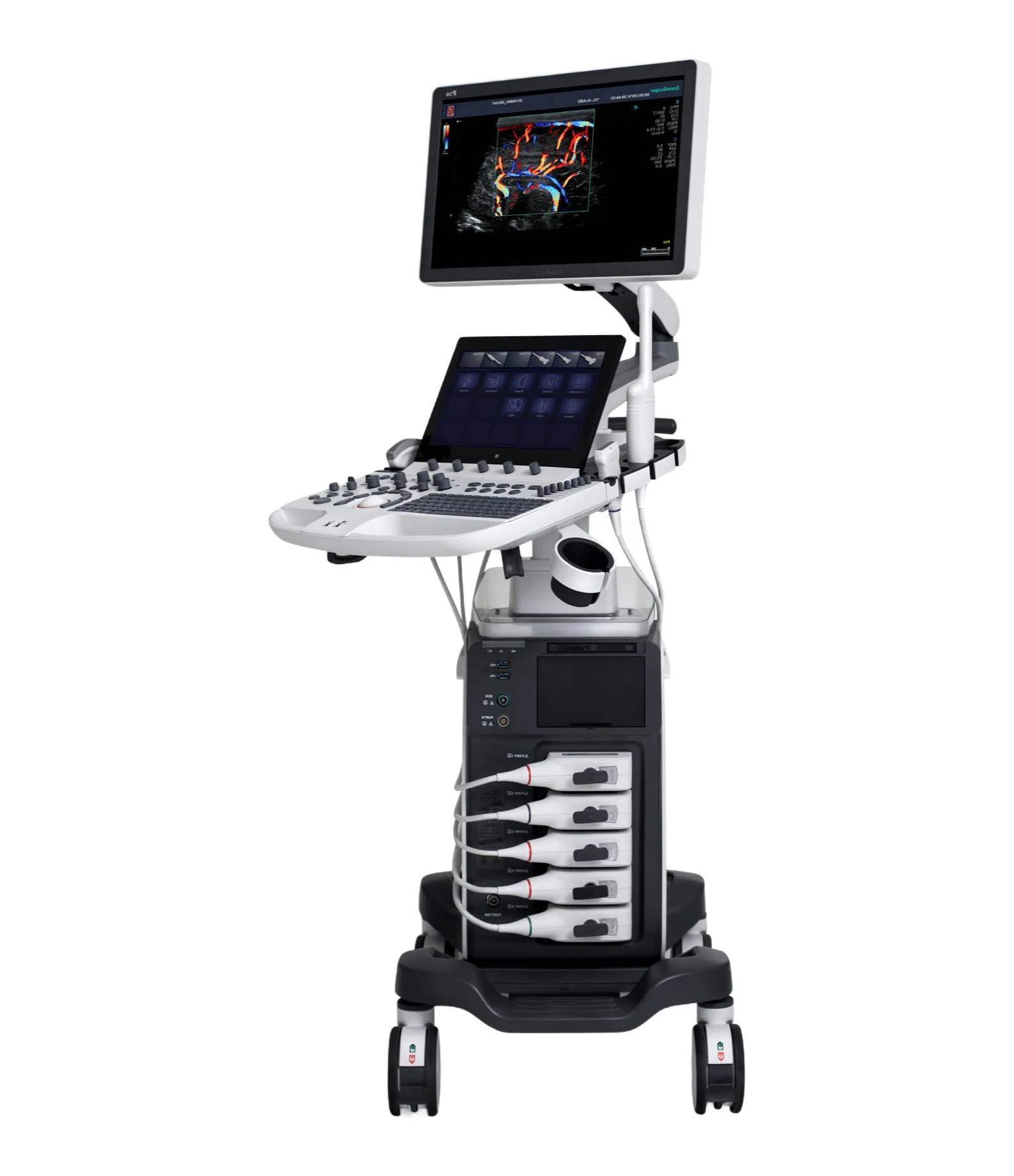 Compact SonoScape P50 5D Ultrasound System for Clinical Examinations and Fetal Abnormalities