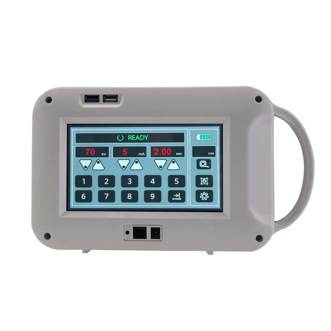 Professional Medical Trolley Doppler Ultrasound Equipment with Adjustable Touch Screen
