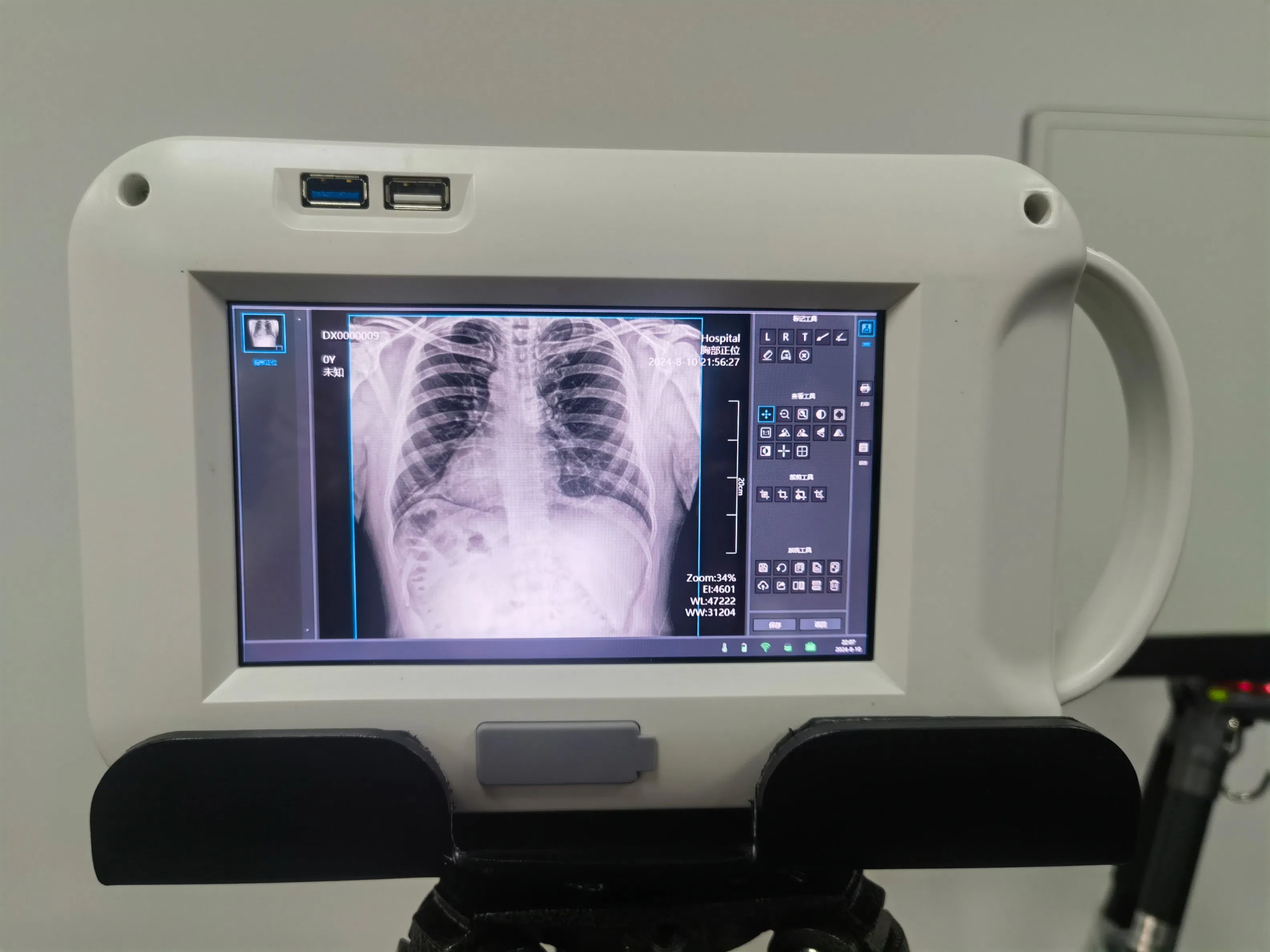 Professional Medical Trolley Doppler Ultrasound Equipment with Adjustable Touch Screen