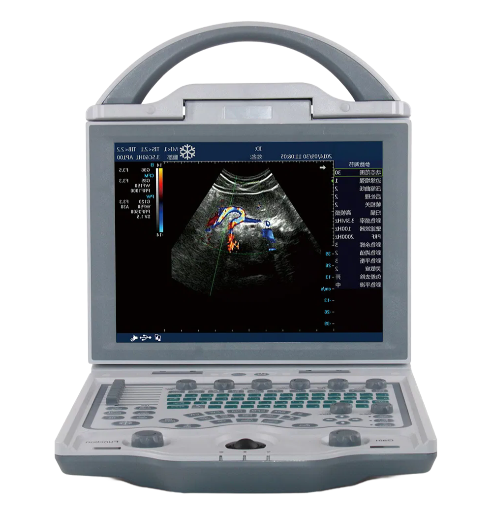Advanced MSLCU23 Color Doppler Ultrasound Machine With 10.4 Inch LCD Display
