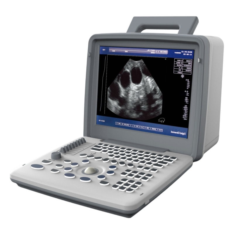 Wholesale UN300 LED Ultrasound Device with OEM Support and Multiple Display Modes for Hospitals