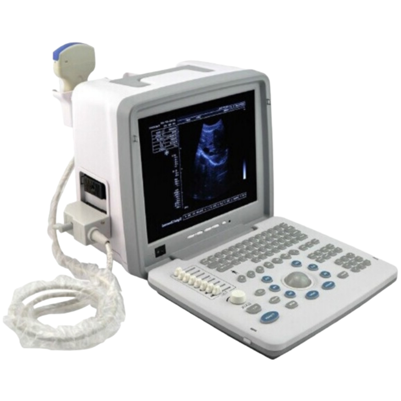 Wholesale UN300 LED Ultrasound Device with OEM Support and Multiple Display Modes for Hospitals