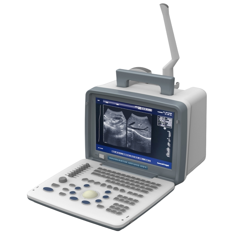 Wholesale UN300 LED Ultrasound Device with OEM Support and Multiple Display Modes for Hospitals