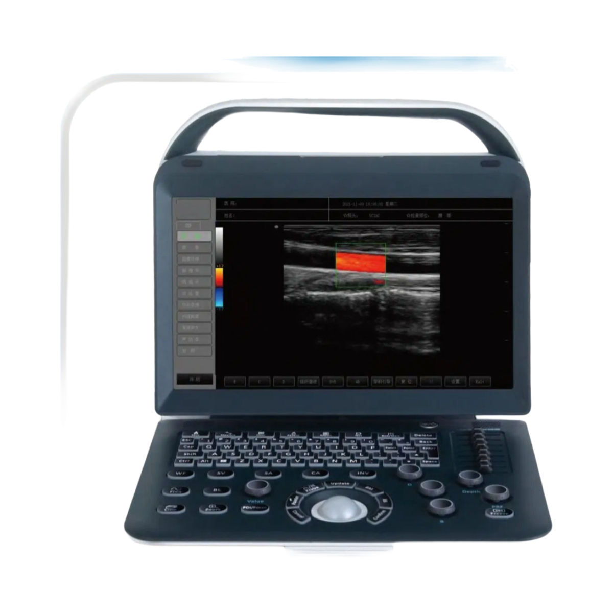 Portable Digital Color Doppler Ultrasound C50 - High Resolution Imaging for Medical Diagnosis
